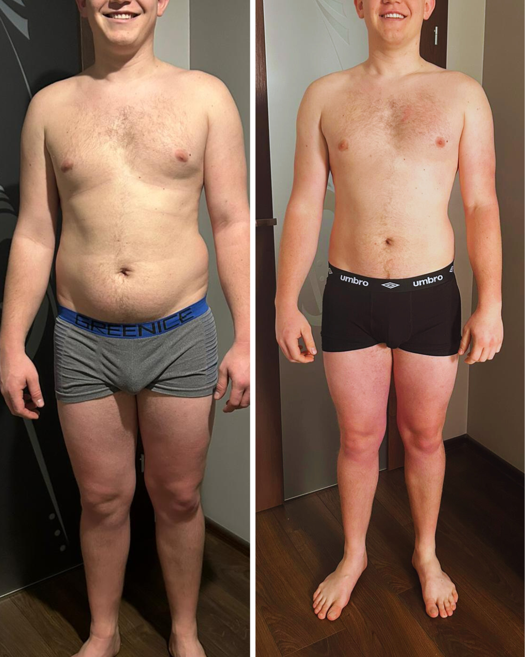 Transformacja podopiecznego 4 - zdjęcie przed i po